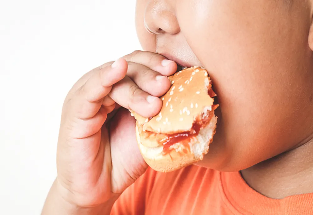 Federația Mondială pentru Obezitate: Peste 220 de milioane de copii ar putea fi obezi până în 2040, dacă nu sunt luate măsuri drastice